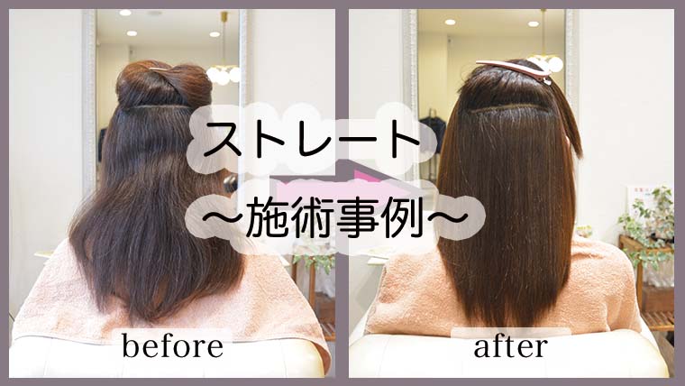 【ケアストレート施術事例】